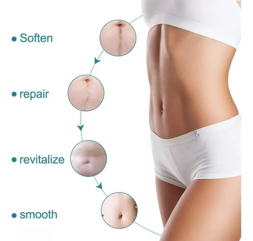 Cinta de Silicona para Cicatrices 4 cm x 1 m.webp